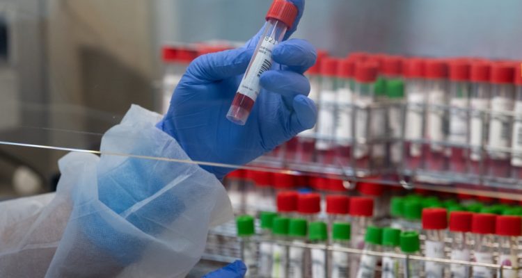 CONTEXTO | Agence France-Presse