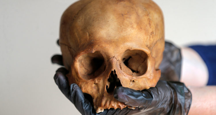 Imagen referencial de un cráneo humano | Agence France-Presse