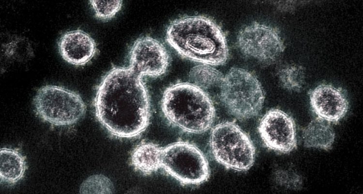 Imagen microscópica de la transmisión del  SARS-COV-2 | AFP