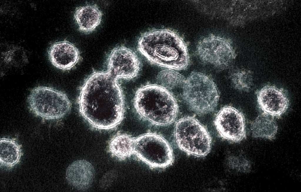 Imagen microscópica de la transmisión del  SARS-COV-2 | AFP