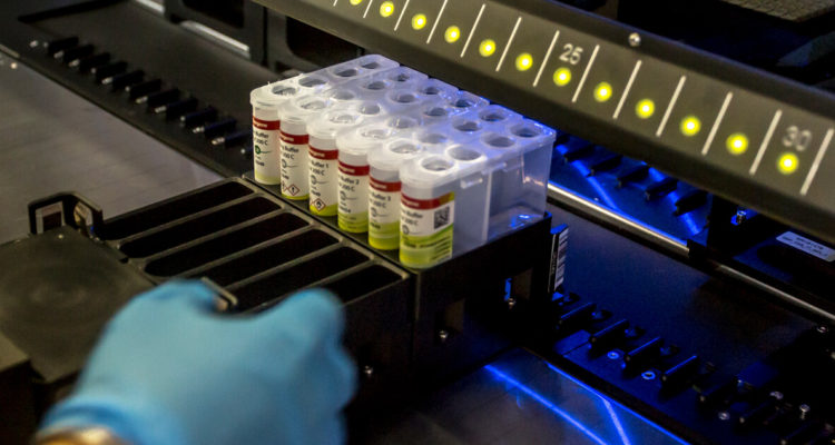 Fernando Lavoz | Agencia UNO