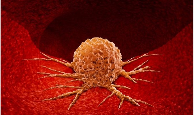 Lightspring/Shutterstock.com