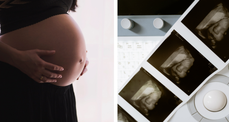 CONTEXTO | Pexels | Edición BBCL