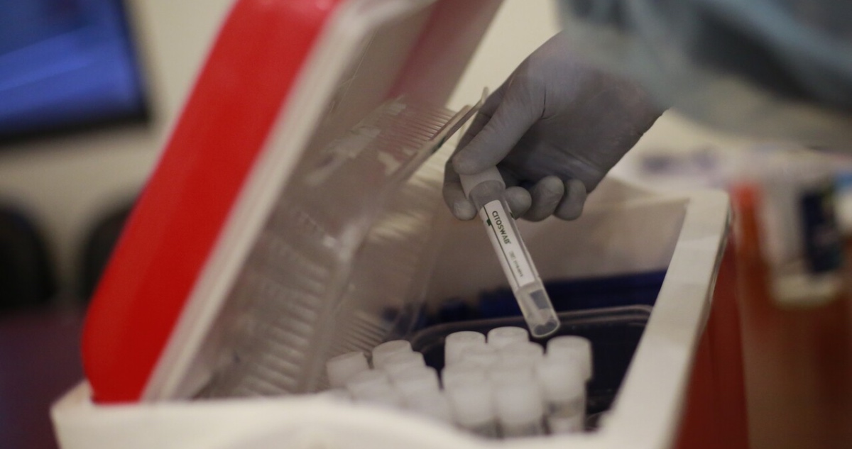 exámenes PCR por casos nuevos covid-19