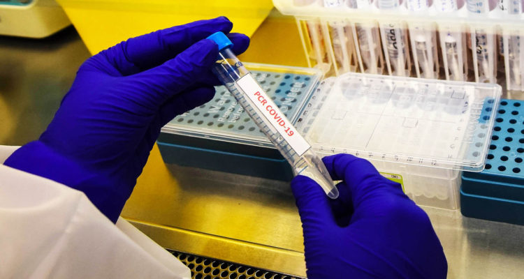 Alza de contagios covid en Chile