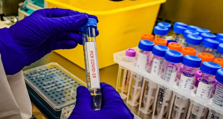 Muestra de examen covid-19.