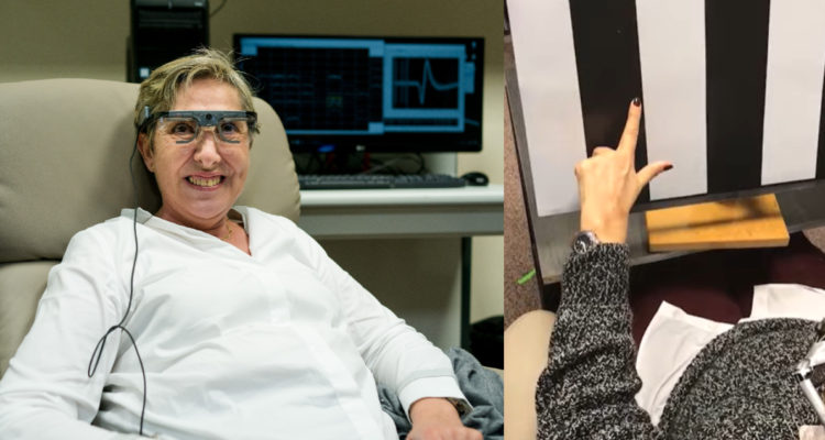 implante cerebral la ayuda a identificar formas y colores