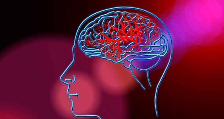 reconocerias-ataque-cerebrovascular-estos-principales-sintomas