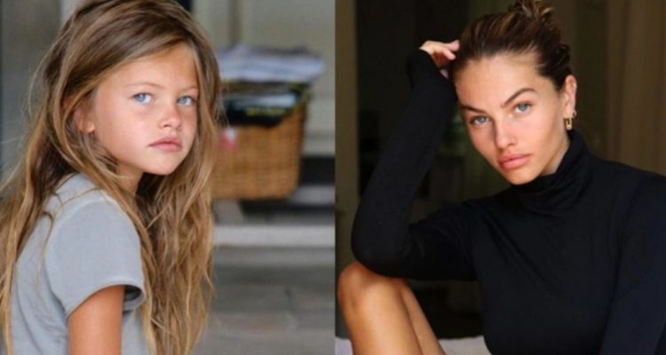 De la niña más bella del mundo a una modelo a la que le explotó un quiste ovárico