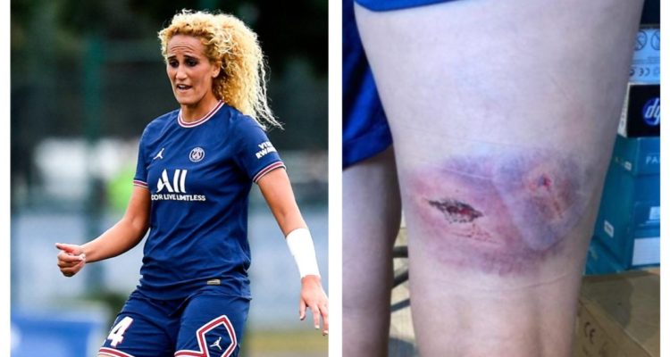 Jugadoras del PSG muestra secuelas de golpiza