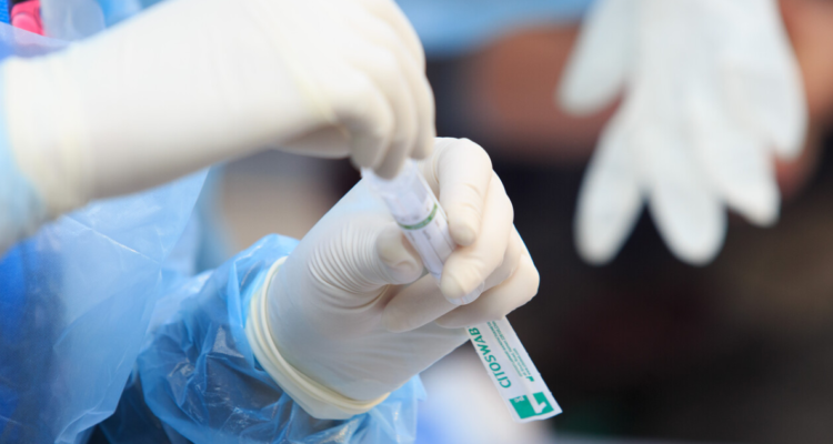 Testeo de PCR para detección de covid
