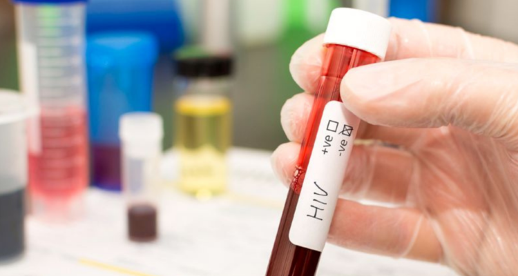 Persona posiblemente curada de VIH