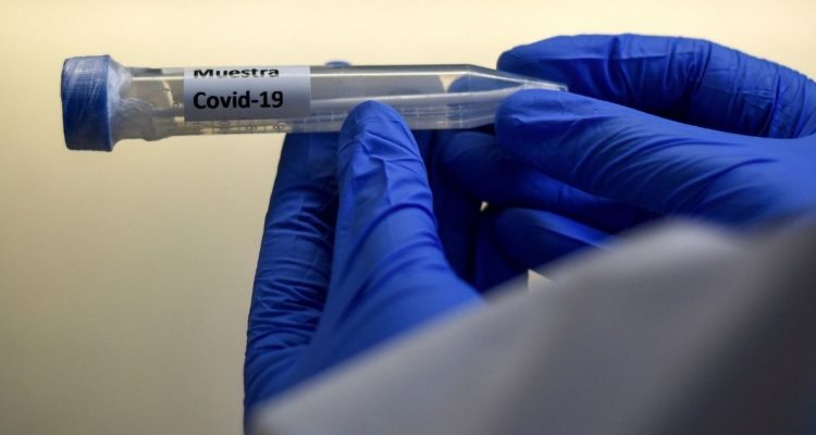 Estudio covid-19 realizado por Ues chilenas cuenta con apoyo de la OMS