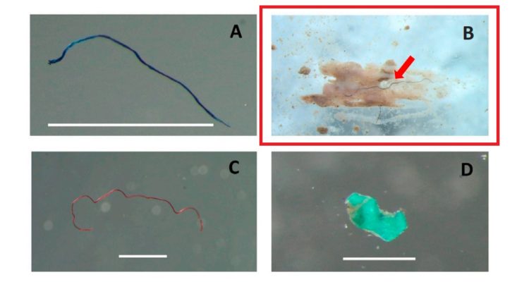 Muestras de microplásticos en boquichicos de Iquitos.