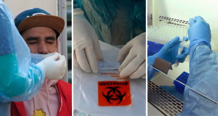 Informe Epidemiológico