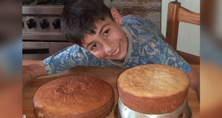 Niño de 10 años trabaja como pastelero para pagar su cirugía de reconstrucción en Argentina
