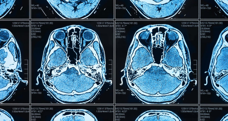 Un conjunto de bioimágenes. Se trata de la vista de una cabeza humana desde dentro.
