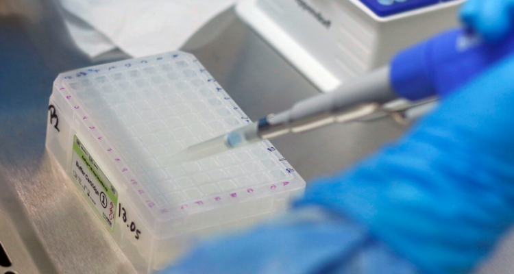 UdeC crea mecanismo para detectar variante Delta en 90 minutos.