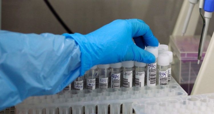 Casos ómicron en Chile