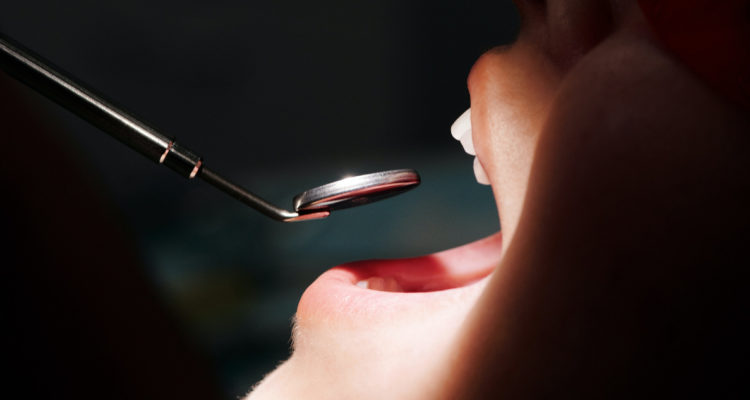 Una persona en el dentista, le revisan si tiene caries en sus dientes.