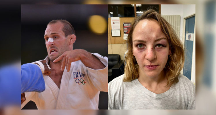 Campeona olímpica denuncia golpiza