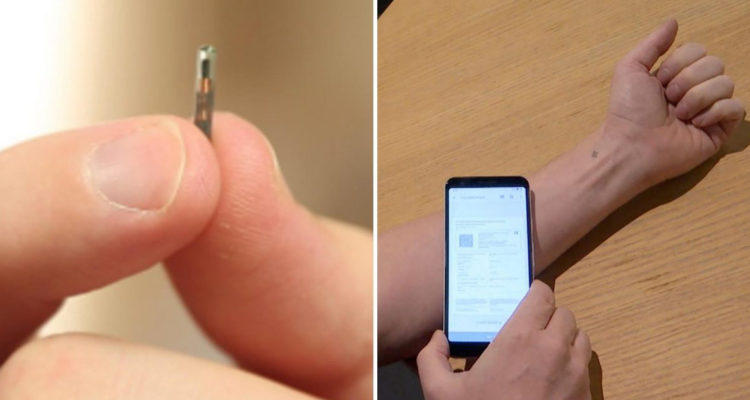El implante microchip que funciona como pase de movilidad.