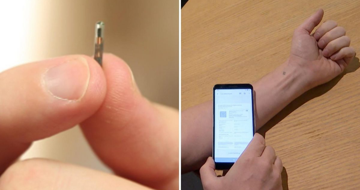 El implante microchip que funciona como pase de movilidad.