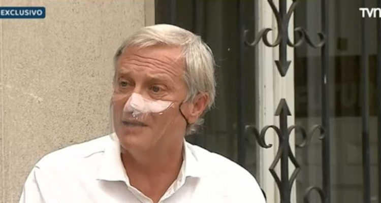 Kast y dudas sobre resultados de las elecciones: “Más que fraude, pueden haber errores”