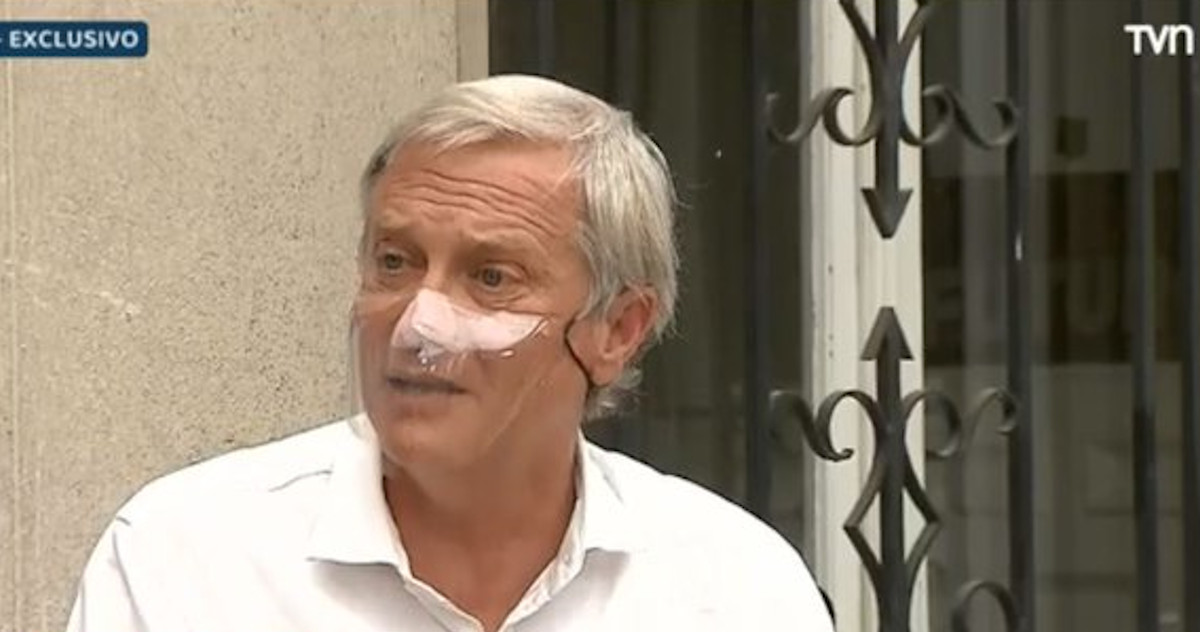 Kast y dudas sobre resultados de las elecciones: “Más que fraude, pueden haber errores”