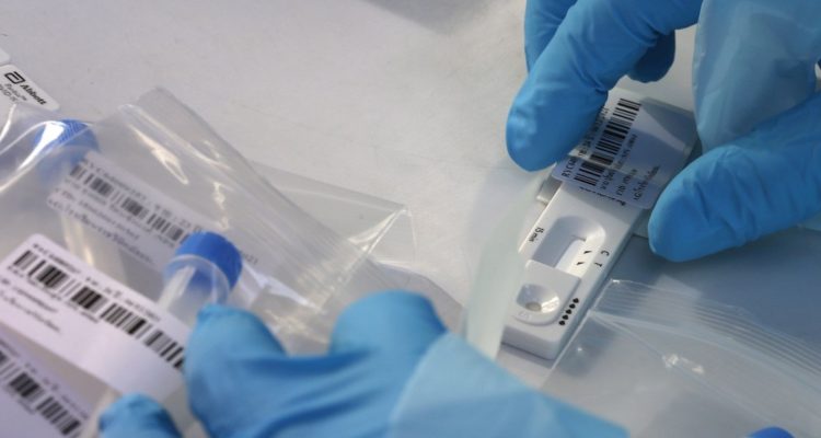 Test de antígenos de covid-19.