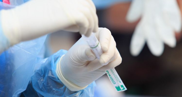 CONFIRMAN CASO DE OMICRON EN OHIGGINS