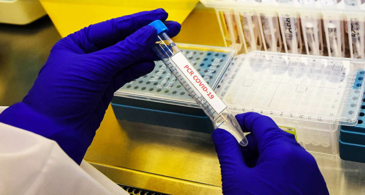 Rusia vuelve a batir récord de contagios diarios con más de 113 mil casos nuevos