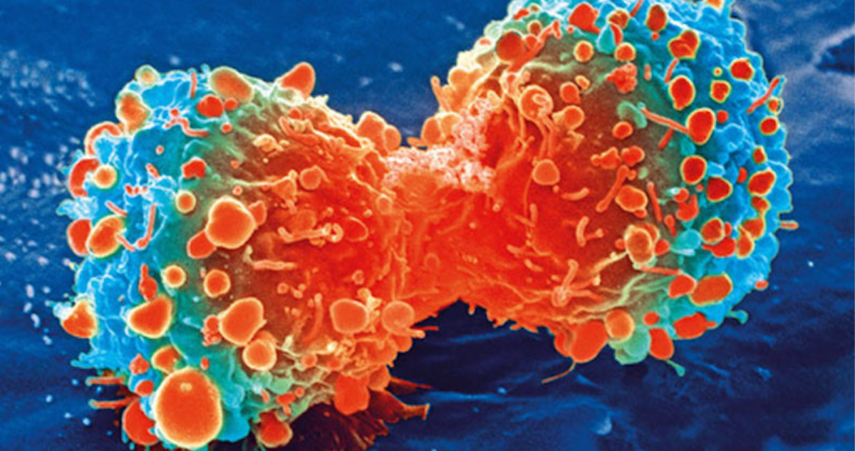 Cáncer