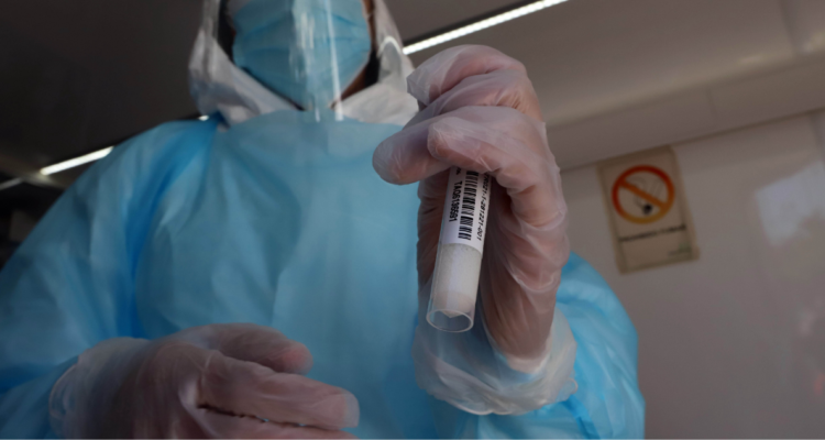 Casos activos disminuyeron en un sólo día