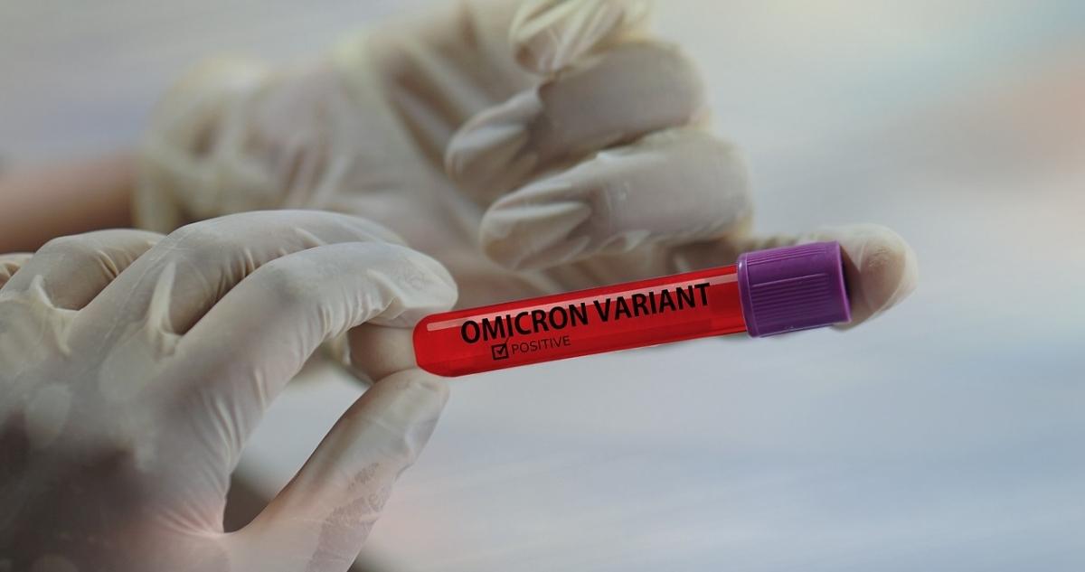 persona-sosteniendo-muestra-variante-omicron