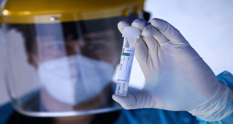 Largas esperas para exámenes PCR marcan la peor semana de la pandemia en el Gran Concepción