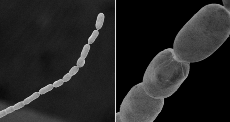 Bacteria 5.000 veces más grande de lo normal
