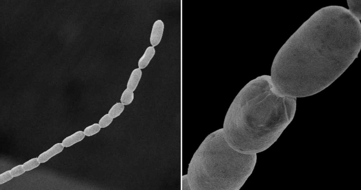 Bacteria 5.000 veces más grande de lo normal