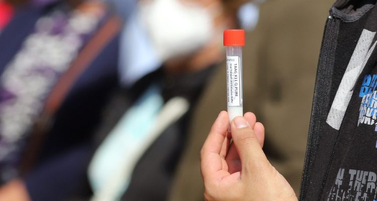 CIFRAS DE COVID EN LOS LAGOS