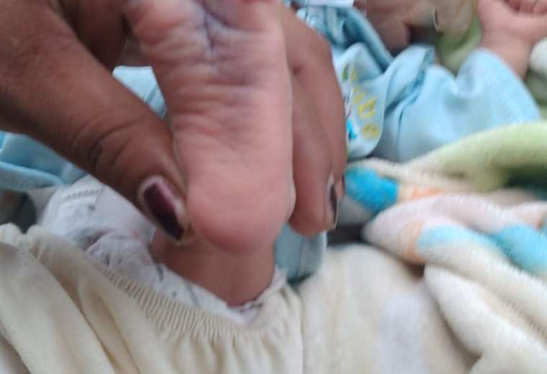 Al bebé abandonado en caja de cartón en Bolivia, le dio covid, pero se recuperó.