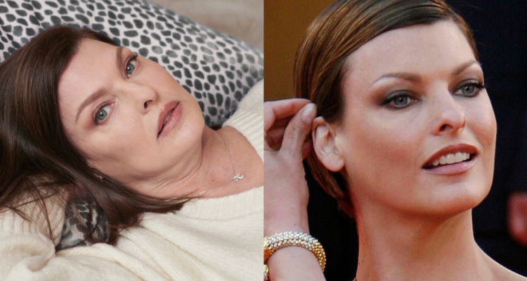 linda-evangelista-hiperplacia-adiposa