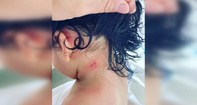 Madre denuncia lesión de su hija en Red Salud Santiago