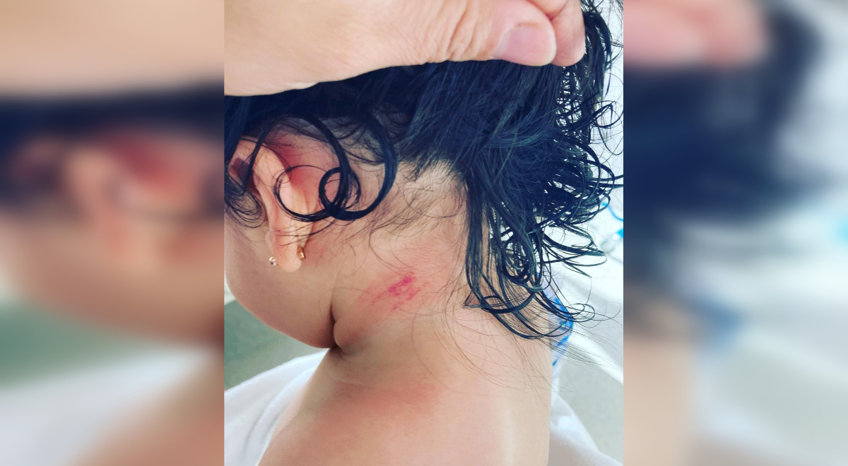 Madre denuncia lesión de su hija en Red Salud Santiago