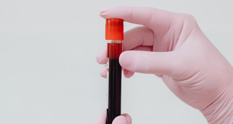 TUBO ENSAYO CON SANGRE