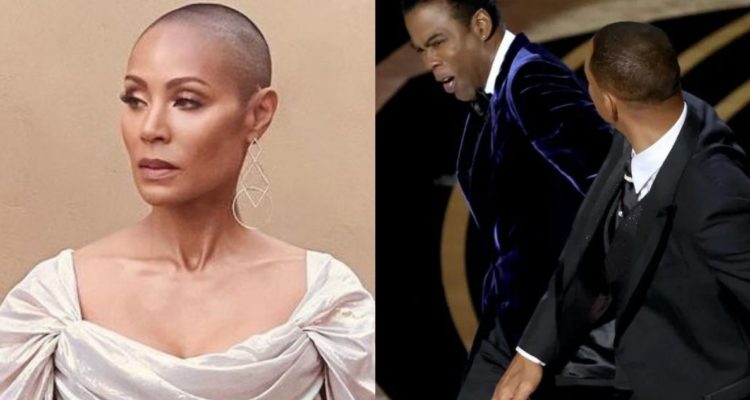 Alopecia areata Jada Pinkett Smith