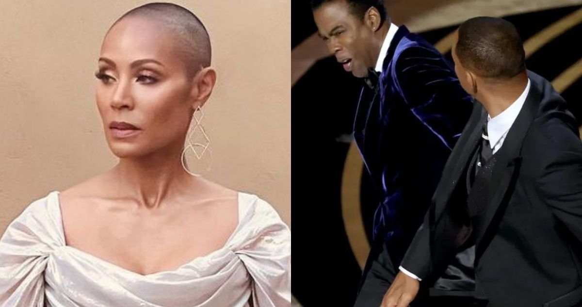 Alopecia areata Jada Pinkett Smith