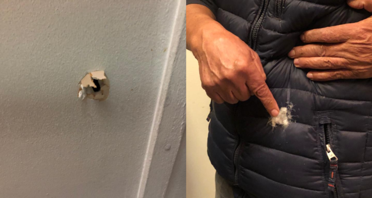 Afectado muestra por dónde ingresó bala y terminó rozando su chaqueta.