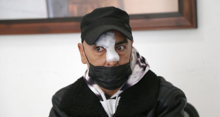 Hombre sufrió brutal golpiza tras ser confundido con delincuente en Coquimbo