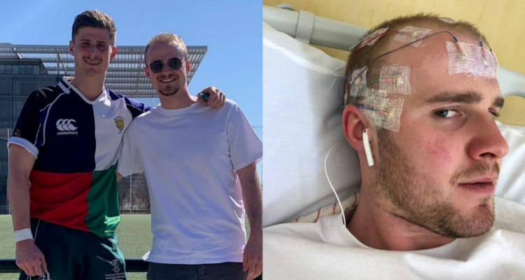 covid-largo-epilepsia