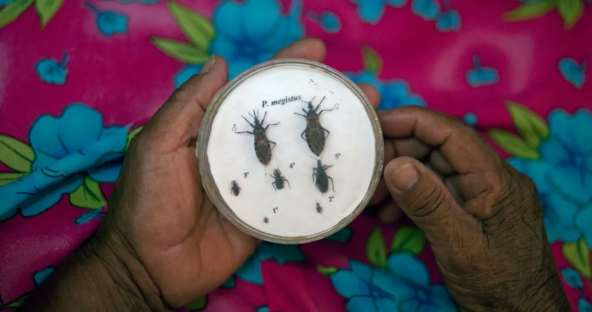chagas-embarazo